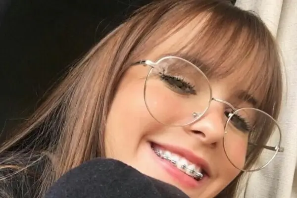 antalya Genç Ortodontik Tedavi